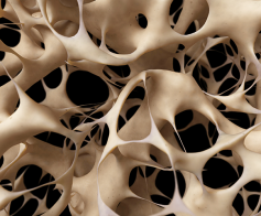 Osteoporozės priežastis