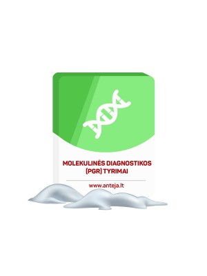 Molekulinės diagnostikos (PGR tyrimai) šlapime Molekulinės diagnostikos (PGR tyrimai) šlapime